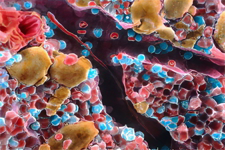 Каков механизм развития Каков механизм развития