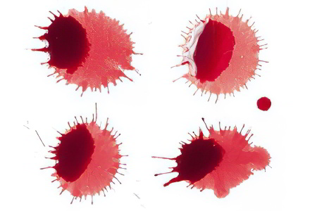 Кровотечение на 7 неделе беременности Кровотечение на 7 неделе беременности