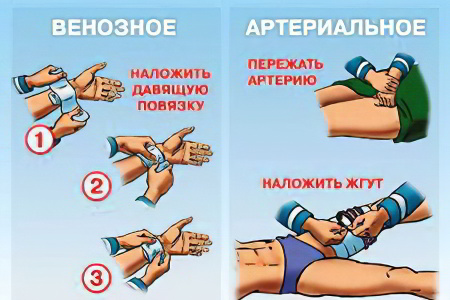 кровотечение кровотечение