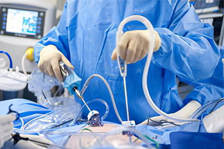 Лапароскопия Лапароскопия