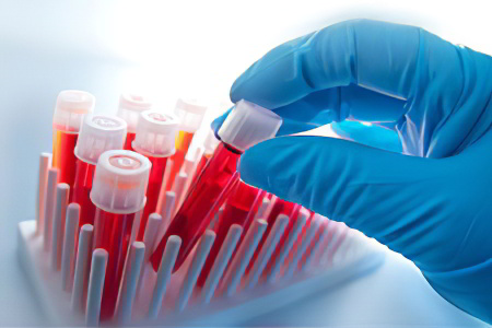 Лечение заболеваний крови Лечение заболеваний крови