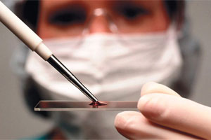 Лечение моноцитопении Лечение моноцитопении