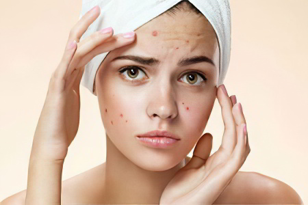 Лечение угрей Лечение угрей