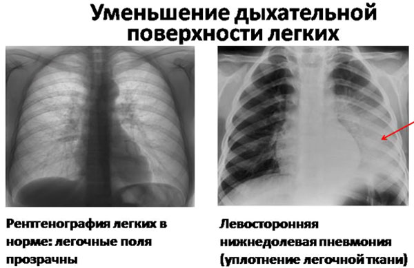 Диагностика Диагностика