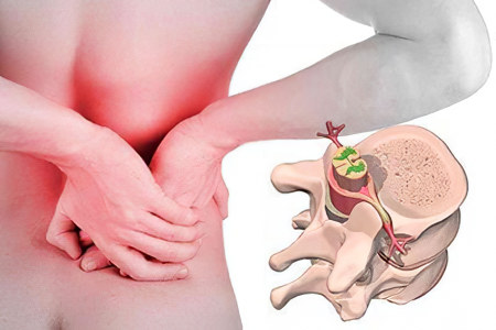 люмбаго люмбаго