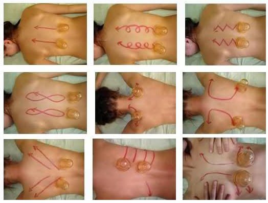 Массаж от целлюлита Массаж от целлюлита