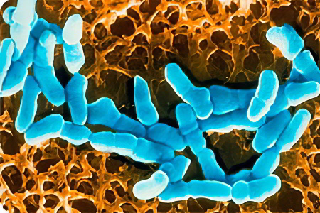 Механизм развития вагинита Механизм развития вагинита