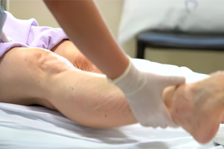 Методы лечения влажной гангрены Методы лечения влажной гангрены