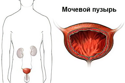 Мочевой пузырь Мочевой пузырь