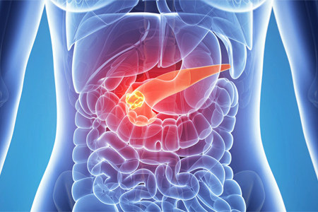 Нарушения в работе поджелудочной железы Нарушения в работе поджелудочной железы