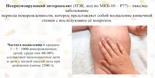 Некротический энтероколит у младенцев Некротический энтероколит у младенцев