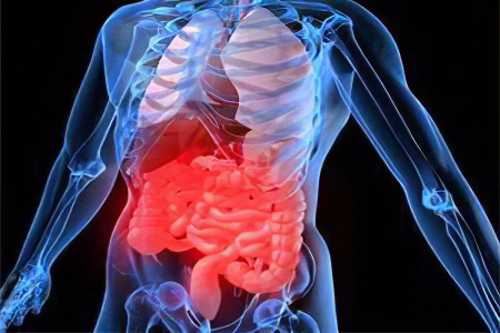 Осложнения язвы желудка Осложнения язвы желудка