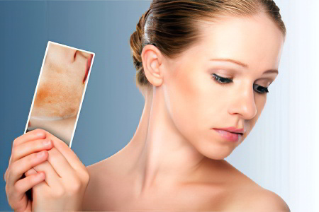 Особенности протекания Особенности протекания