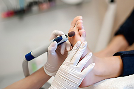 Аппаратный педикюр для удаления мозолей Аппаратный педикюр для удаления мозолей