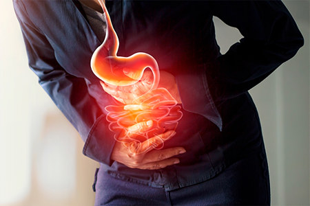 Заворот кишечника Заворот кишечника