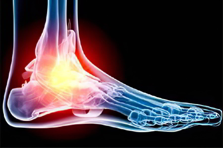 Почему болят суставы ног Почему болят суставы ног