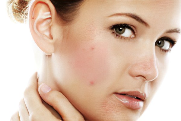 Причины аллергии Причины аллергии