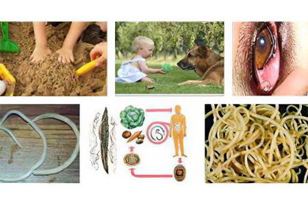 Причины гельминтов Причины гельминтов