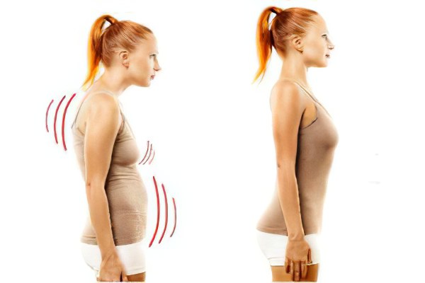 Причины кифоза грудного отдела Причины кифоза грудного отдела