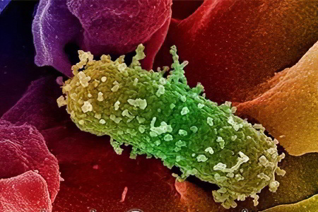 Причины поноса Причины поноса