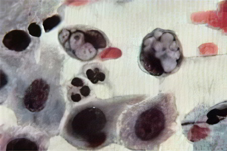 Причины заражения хламидиозом Причины заражения хламидиозом