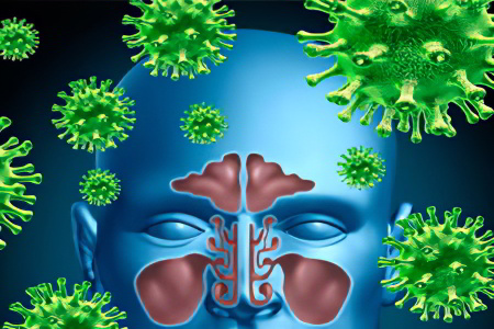 Причины фронтита Причины фронтита