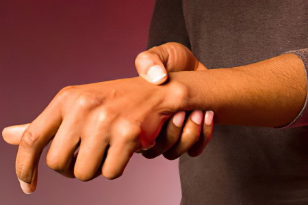 Причины гигромы Причины гигромы