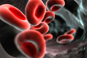 Причины гипопротеинемии Причины гипопротеинемии