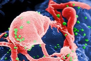 Причины лимфоцитоза Причины лимфоцитоза