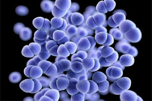 Причины моноцитопении Причины моноцитопении