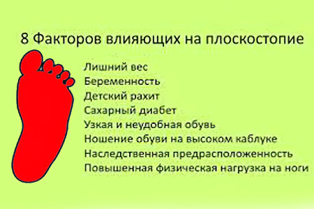 Причины плоскостопия Причины плоскостопия