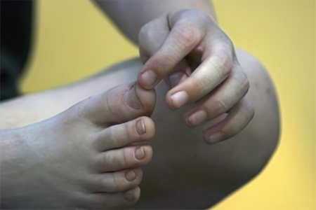 Причины влажной гангрены Причины влажной гангрены