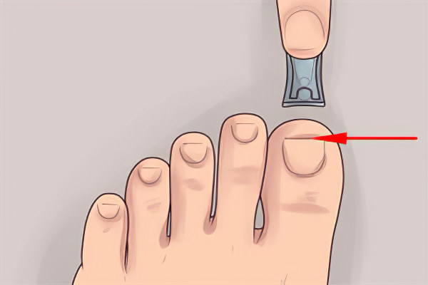 Профилактика Профилактика