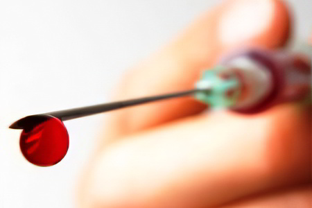 Противопоказания к аутогемотерапии Противопоказания к аутогемотерапии