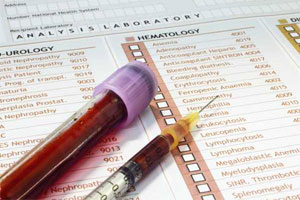 Протромбиновое время Протромбиновое время