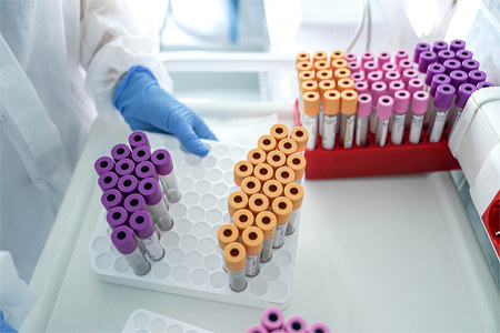 Кому нужно пройти исследование Кому нужно пройти исследование