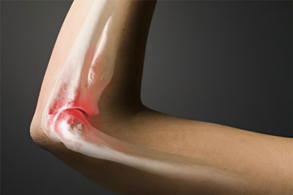 Рак костей с метастазами Рак костей с метастазами