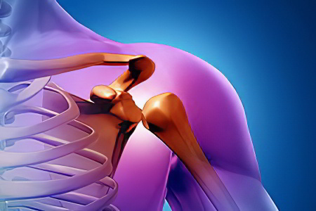 рак костей рак костей