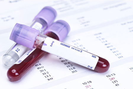 Расшифровка анализа на моноциты Расшифровка анализа на моноциты