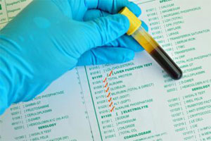 Расшифровка результатов коагулограмм Расшифровка результатов коагулограмм