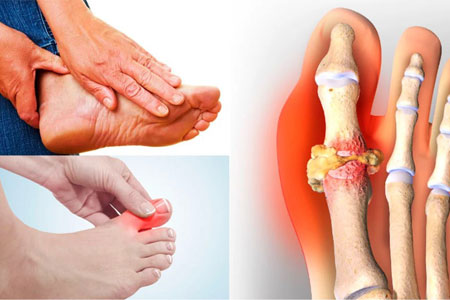 Роль мочевой кислоты Роль мочевой кислоты