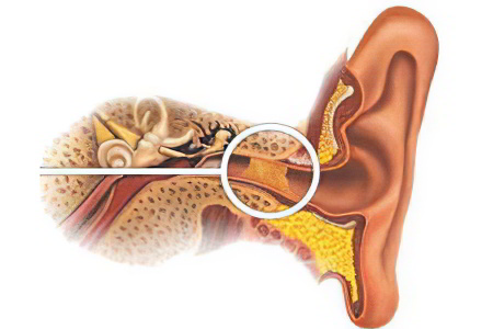 Серная пробка Серная пробка