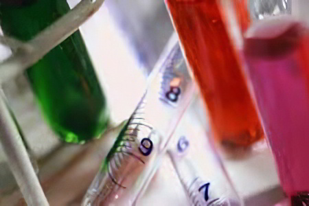 Щелочная фосфатаза понижена Щелочная фосфатаза понижена