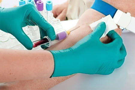 Щелочная фосфатаза повышена Щелочная фосфатаза повышена