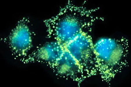 щелочная фосфатаза щелочная фосфатаза