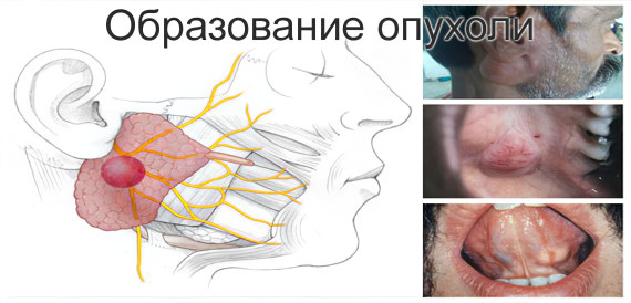 Осложнения заболевания Осложнения заболевания