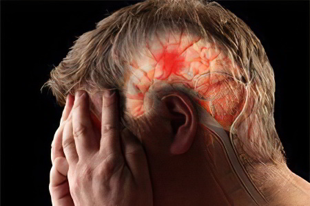 Симптомы инфаркта головного мозга Симптомы инфаркта головного мозга