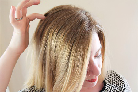 Симптомы жировика на голове Симптомы жировика на голове