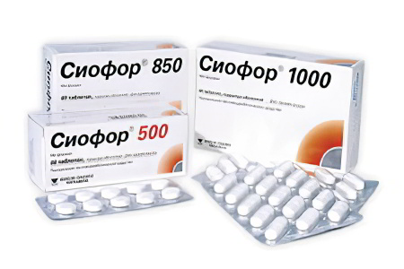 Сиофор в гинекологической практике Сиофор в гинекологической практике