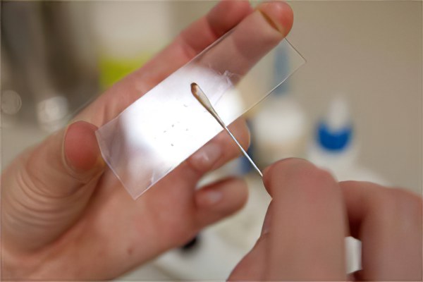 Сколько действителен анализ на энтеробиоз Сколько действителен анализ на энтеробиоз